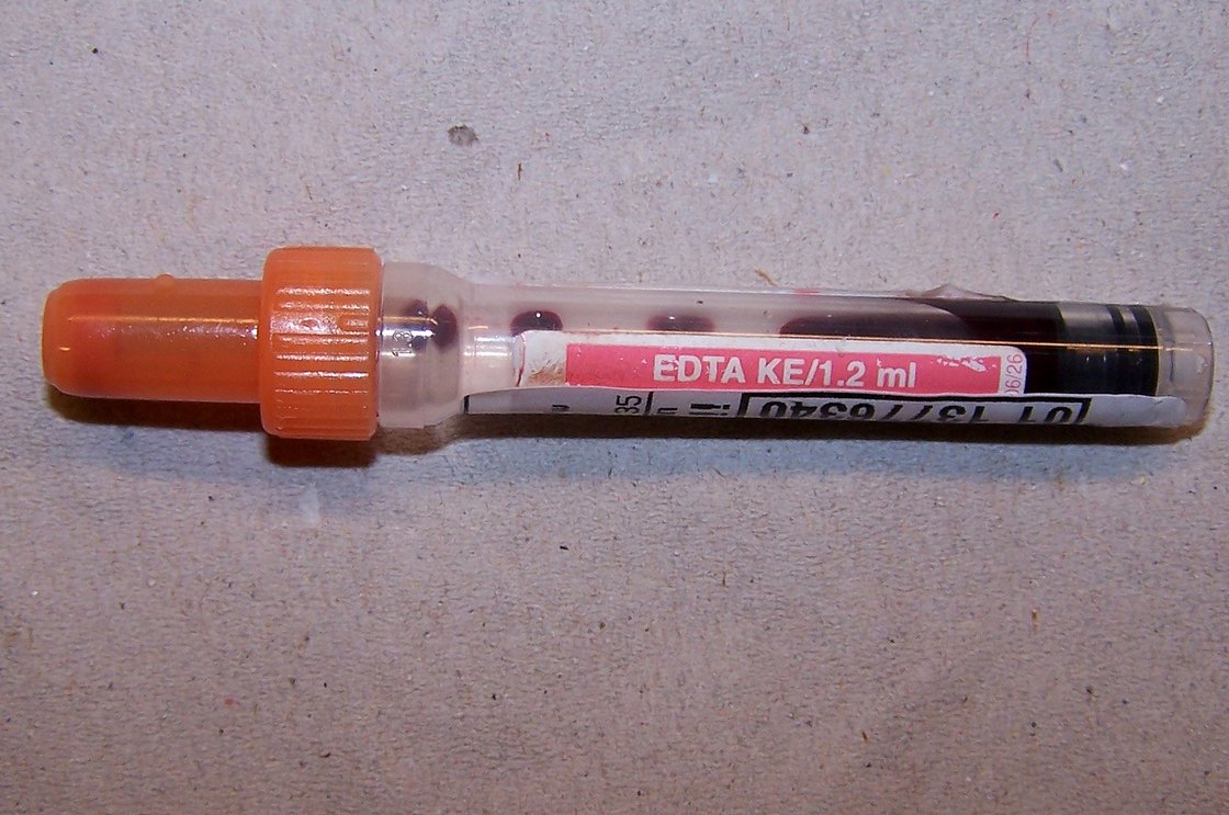 Foto einer 2 ml-EDTA-Monovette mit dem Deckel einer Lithium-Heparin-Monovette.