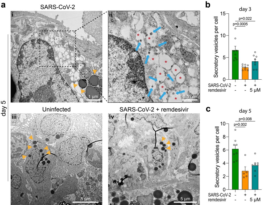 Infection by SARS-CoV-2 was further imaged using transmission electron microscopy. Infection of islet cells altered the endoplasmic reticulum (ER)–Golgi apparatus complex. Moreover, we showed that secretory vesicles seemed to be enlarged and maintained in the perinuclear region. Furthermore, infection decreased granule numbers in infected islets.