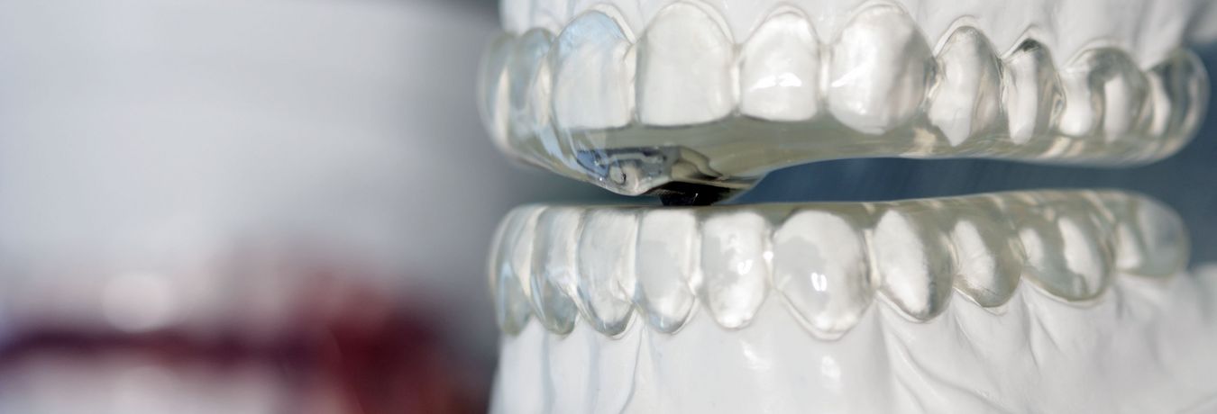 Abbildung: Beispiel von Protrusionsschienen am Zahnmodell